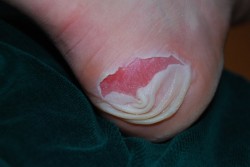 terrible heel blisterf needs to get home 07.jpg